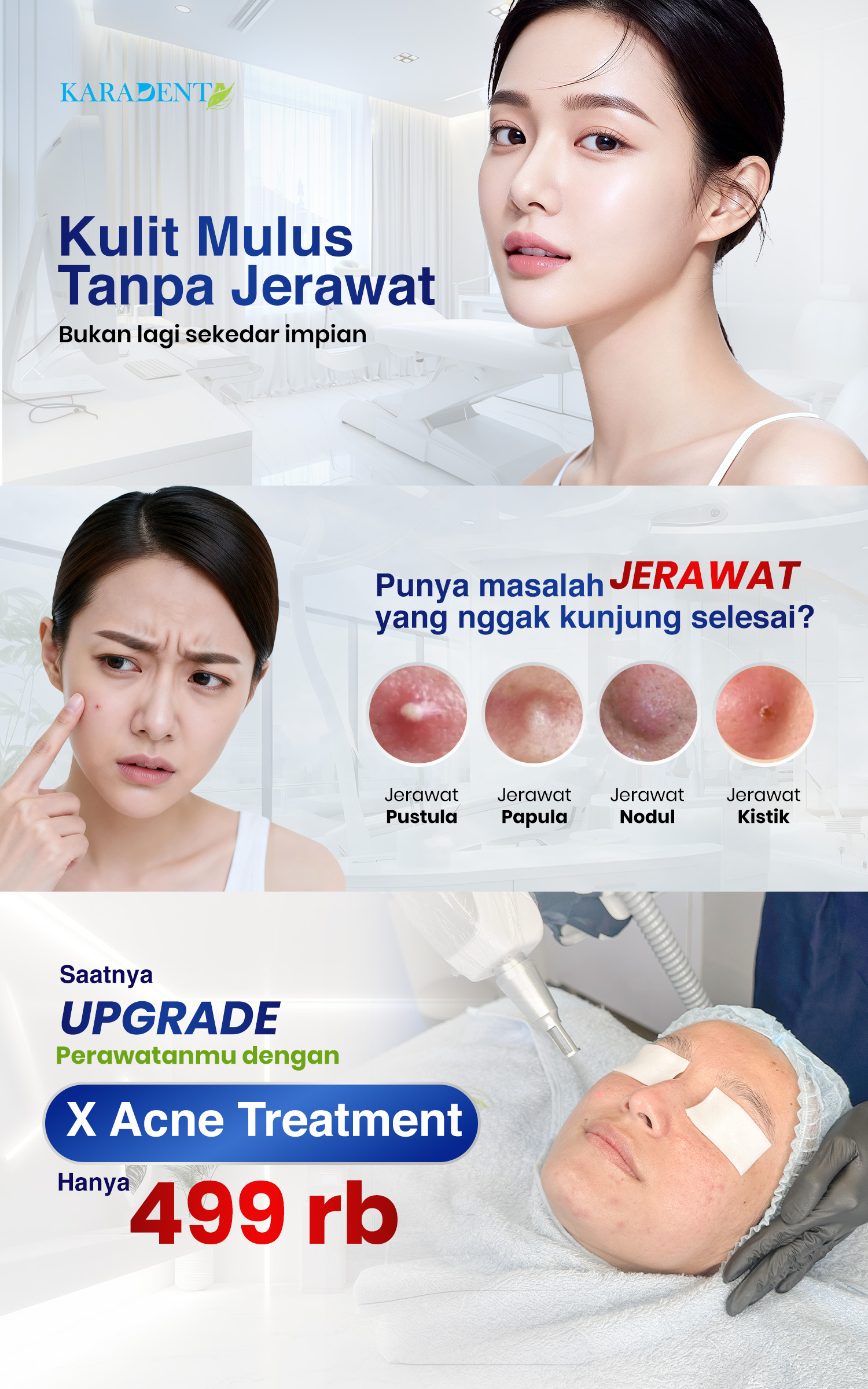 Kulit Mulus Tanpa Jerawat