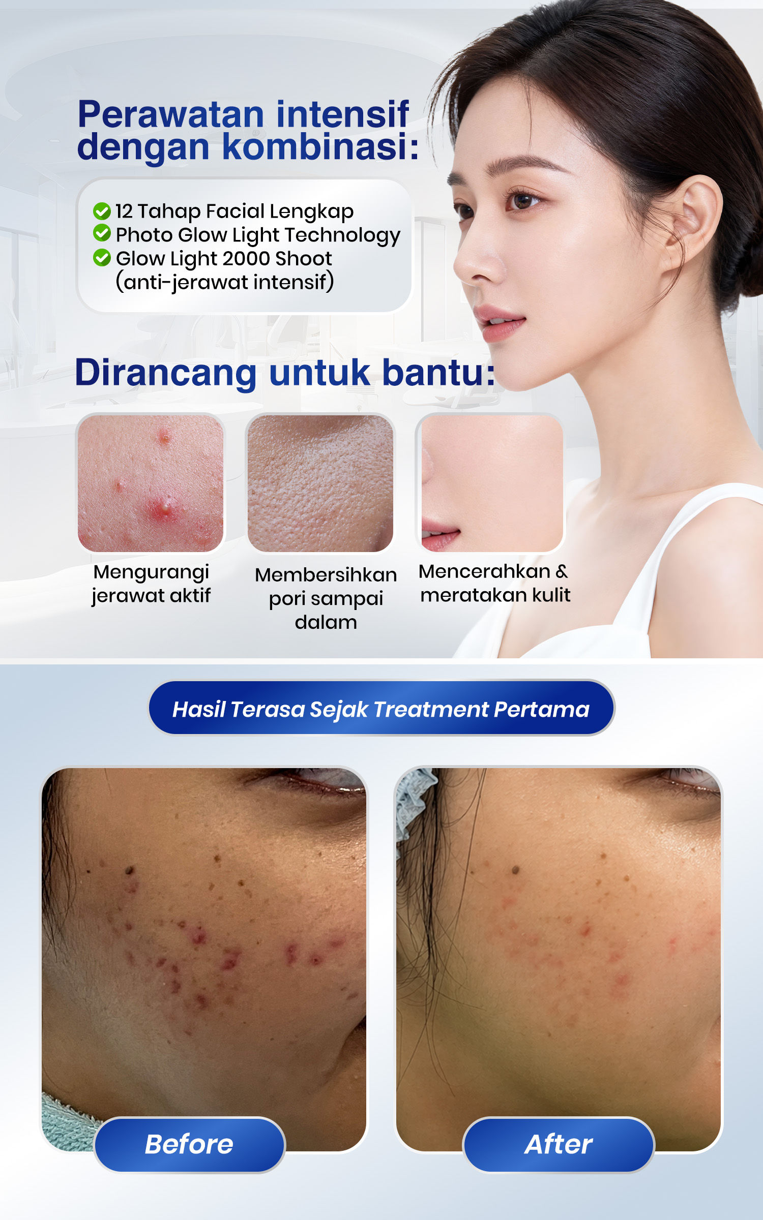 Kulit Mulus Tanpa Jerawat